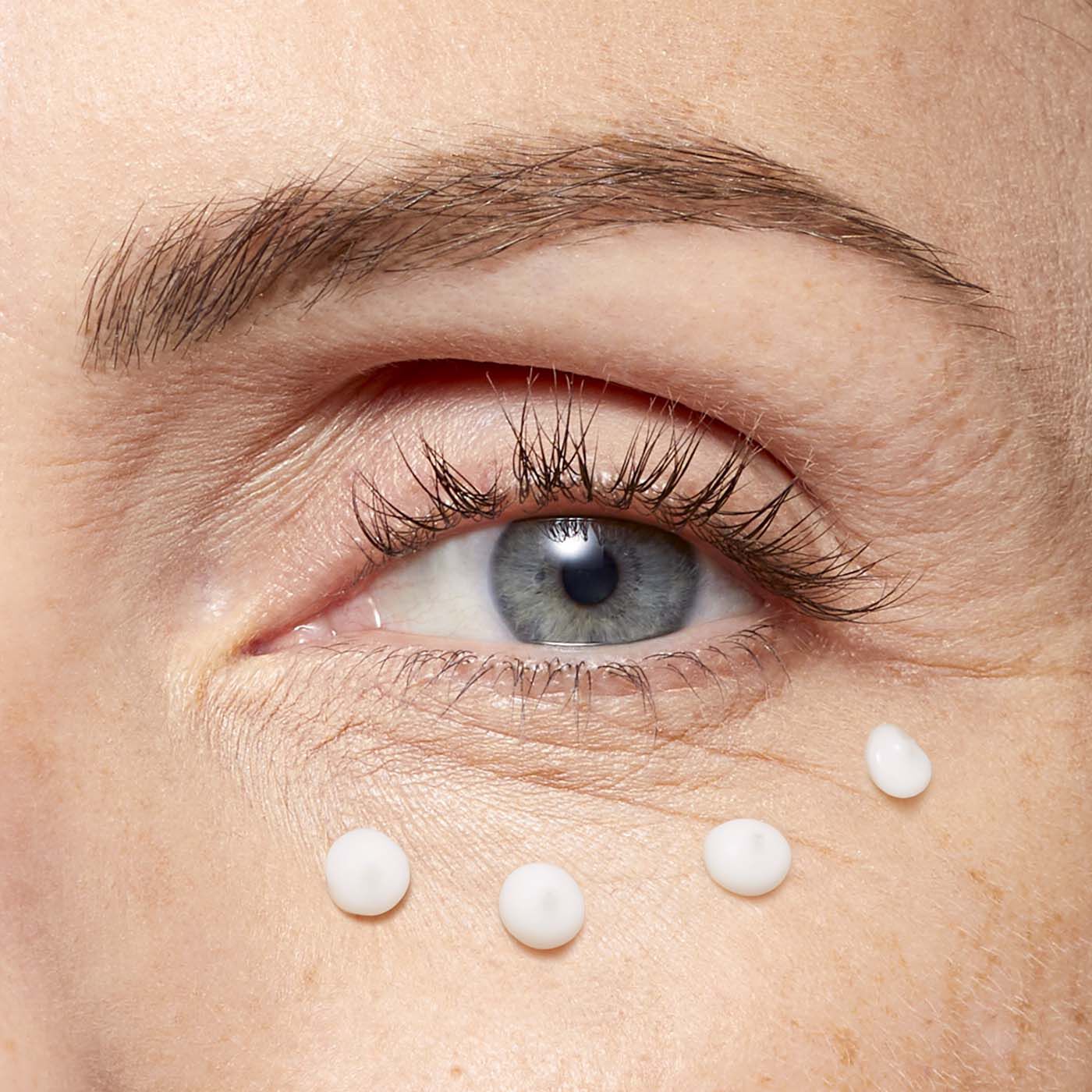 Total Eye Lift